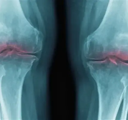 غضروف — SA news