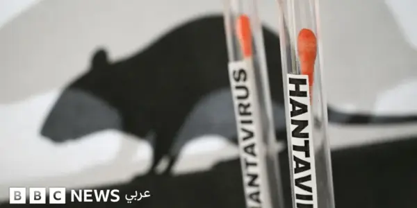بفيروس هانتا — SA news